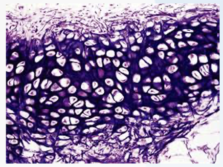 <p>great flexibility so that it is able to withstand repeated bending. The chondrocytes lie between the ribers. It is found in the epiglottis (part of larynx), the pinnae (external ear flaps of many mammals)</p>