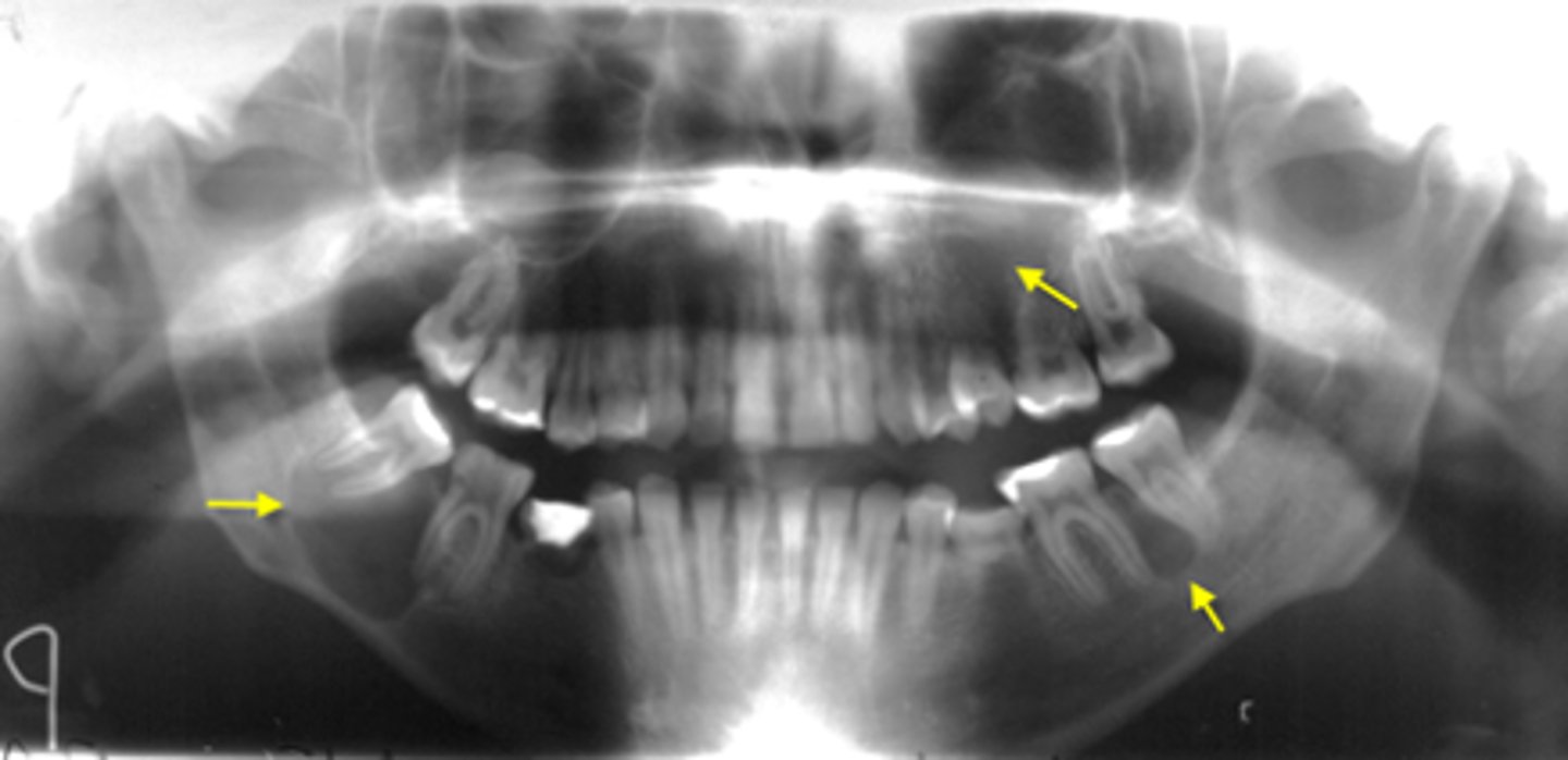 <p>ID the cyst:</p>