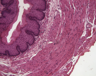<p>Organ?</p><p>Structure in submucosa?</p>