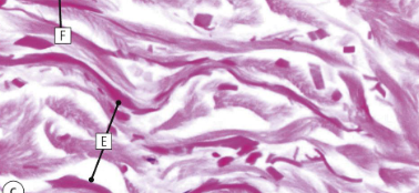 <p>what type of fibres are shown here </p>