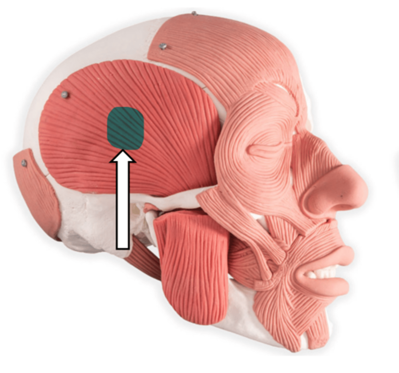 <p>name the muscle</p>