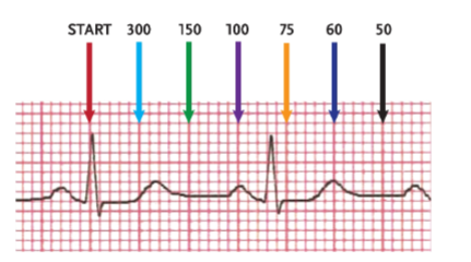 <p>method used to determine heart rate from an EKG tracing that involves counting the numbers of large blocks between two consecutive R waves and dividing that number into 300, which is the number of large blocks in a one-minute EKG strip; also called the 300 method</p>