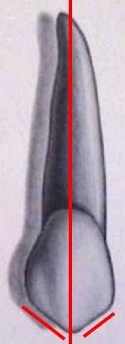 <p>False</p>