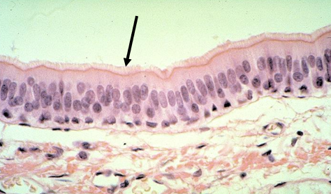 <p>What is the BLACK arrow pointing at?</p>