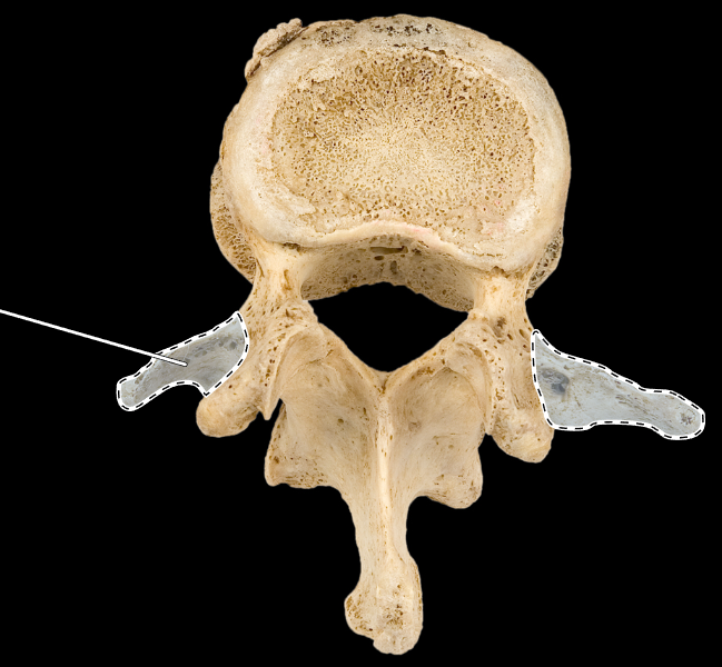 <p>What part of the vertebra is highlighted?</p><p>What type of vertebra is this (which region is this vertebra from)?</p><p>(Superior view).</p>