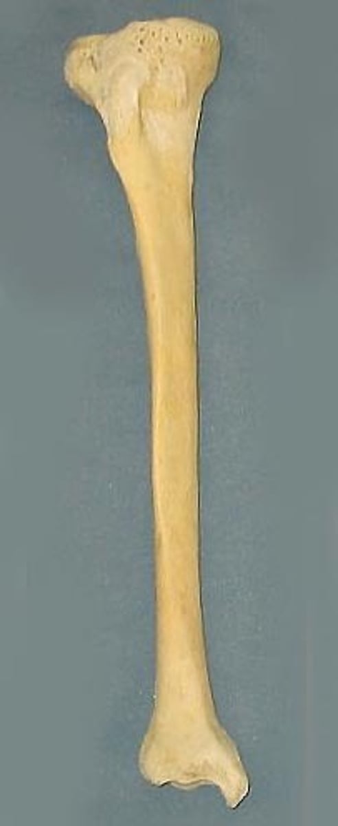 <p>ID bone</p>