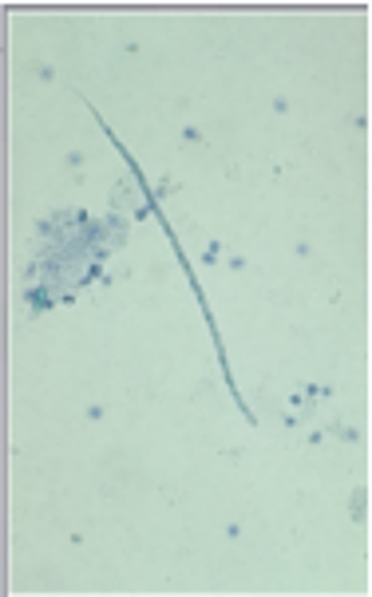 <p>Microfilariae like the one in the image was found in a 6-year- old poodle and measures 265 um in length. The dog was on monthly prevention. What is the significance of finding this parasite?</p>