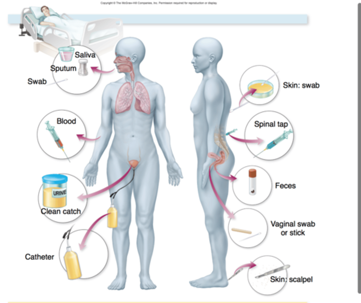 <p>aseptic technique is imperative</p><p>sterile sample containers</p><p>prevent contamination</p>