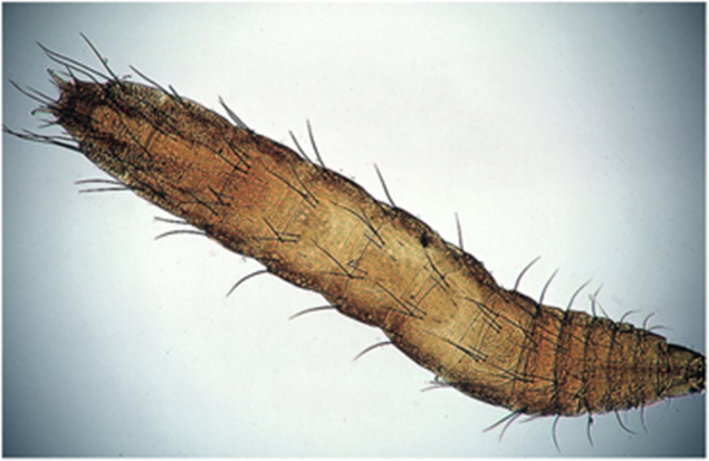 <p>The larval form of this parasite is sparsely covered with fine hairs and ingests organic debris</p><p>from the environment. Adults are commonly seen on dogs and cats. What is this parasite?</p>
