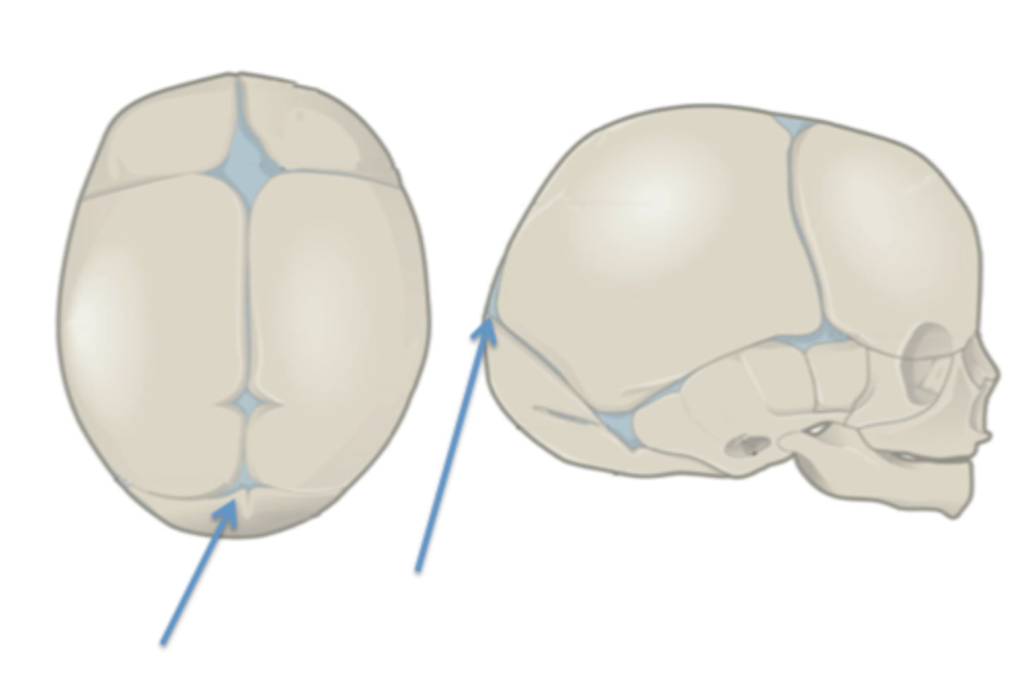 <p>Identify this fetal skull structure.</p>