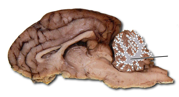 <p>Name the highlighted part of the brain.</p>