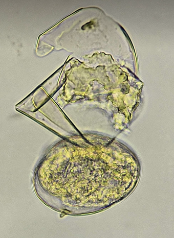 <p><span data-name="microscope" data-type="emoji">🔬</span><span data-name="petri_dish" data-type="emoji">🧫</span><strong><span> </span>Na podstawie zdjęcia preparatu:</strong></p><p></p><ul><li><p><span data-name="book" data-type="emoji">📖</span><span> </span>rozpoznaj gatunek pasożyta;</p></li></ul><p></p><ul><li><p><span data-name="recycle" data-type="emoji">♻</span><span> </span>rozpoznaj wszystkie formy rozwojowe;</p></li></ul><p></p><ul><li><p><span data-name="microbe" data-type="emoji">🦠</span><span> </span>wskaż organelle i cechy charakterystyczne dla danego gatunku;</p></li></ul><p></p><ul><li><p><span data-name="mask" data-type="emoji">😷</span><span> </span>nazwij chorobę, którą pasożyt wywołuje.</p></li></ul><p></p>