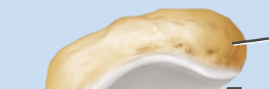 What’s the ulna structure