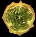 <p>Identify the ovule placentation.</p>