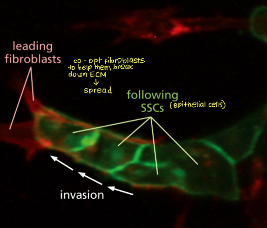 <p>basement membrane and extracellular matrix (ECM)</p><p>fibroblasts and stromal cells degrade the ECM</p>