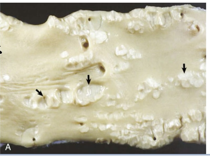 <p>what are the arrows showing?</p>