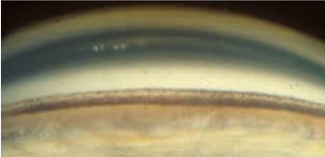 <p>identify the most posterior structure shown in this image &amp; what is its function? </p>