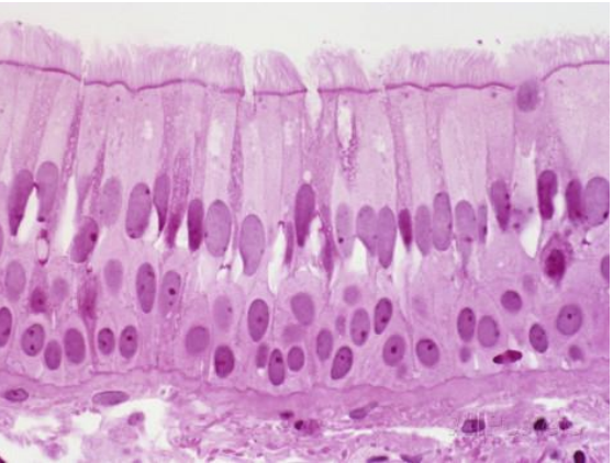 <p>psuedostratified ciliated columnar epithelial tissue</p>