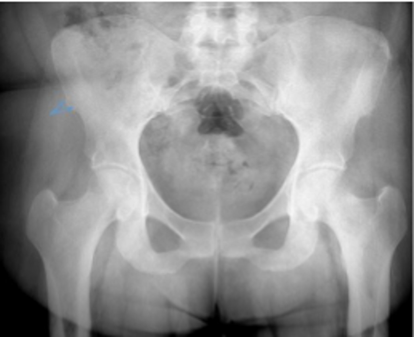 <p>What are the arrows pointing to?</p>