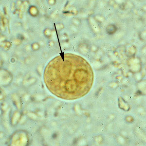 <p><span>Entamoeba Histolytica cyst</span></p>