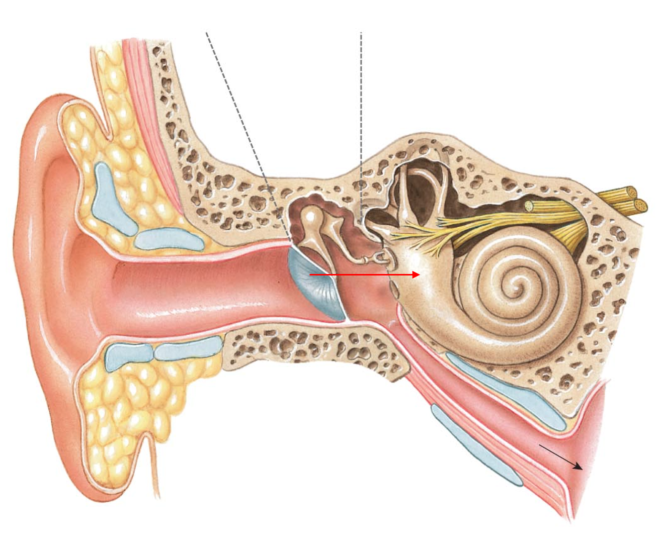 term image