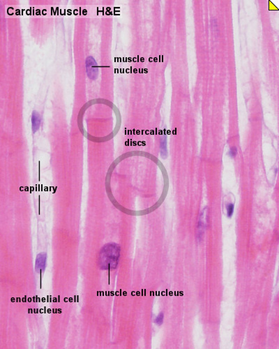 <p>intercalated discs* only muscle type*, involuntary controlled, striations</p>