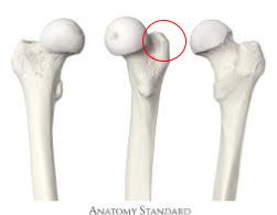 <p>large projection at the lateral and proximal side of the femur</p>