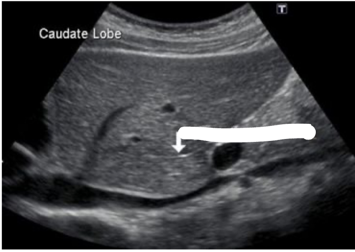 <p>What is the arrow pointing at?</p>