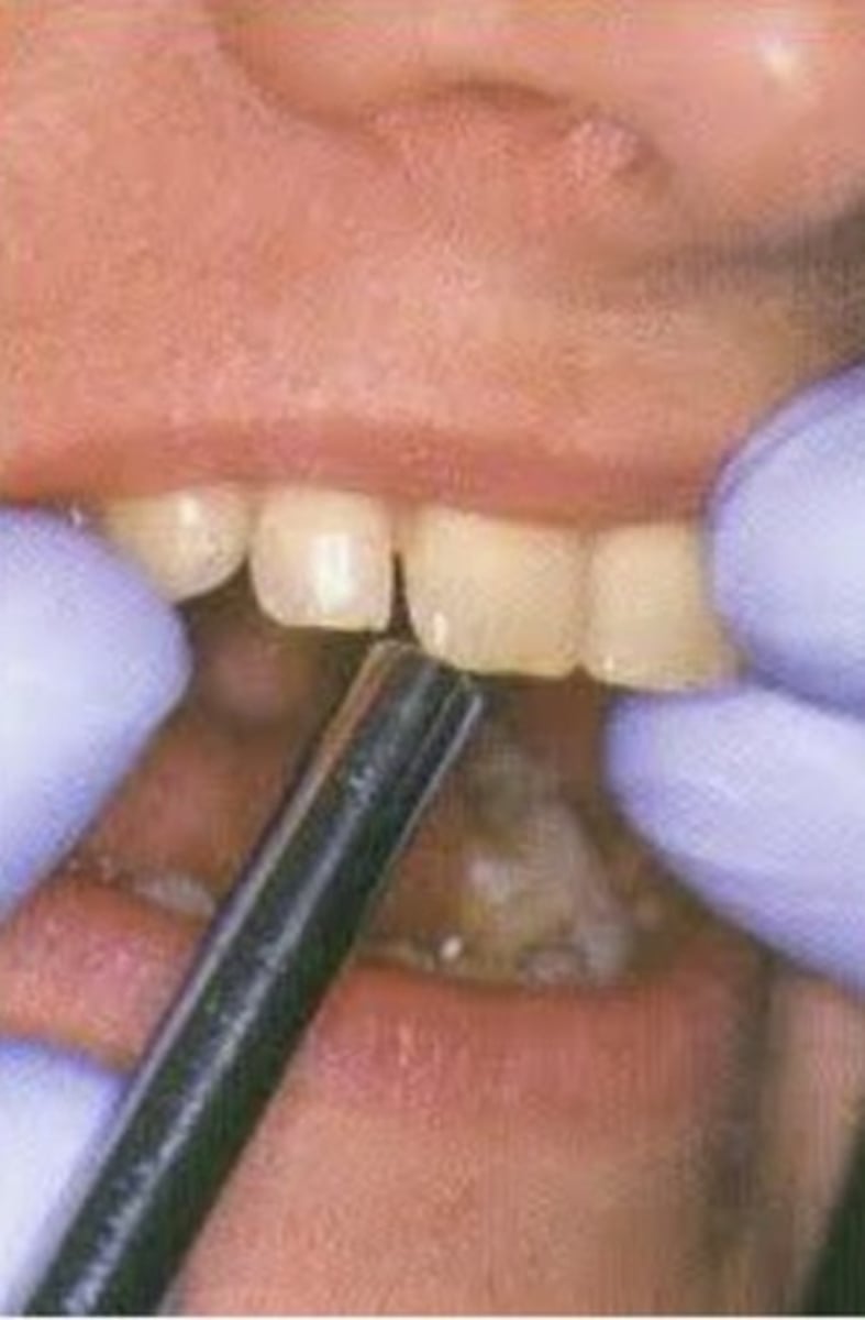 <p>How is percussion used for diagnostic testing?</p>