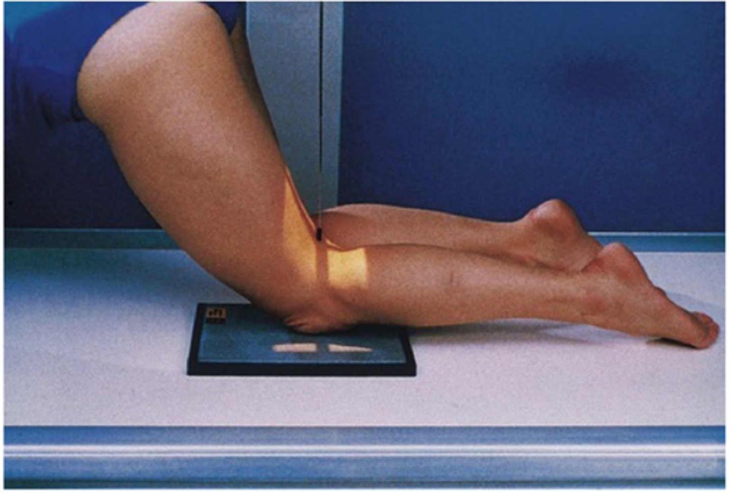 <p>projection for the intercondylar fossa in profile</p><p>pt kneeling, leaned forward 20-30 degrees degrees</p><p>CR perpendicular to IR and lower leg, direct CR to midpopliteal crease</p>
