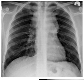 <p>what is this? and what causes it</p>