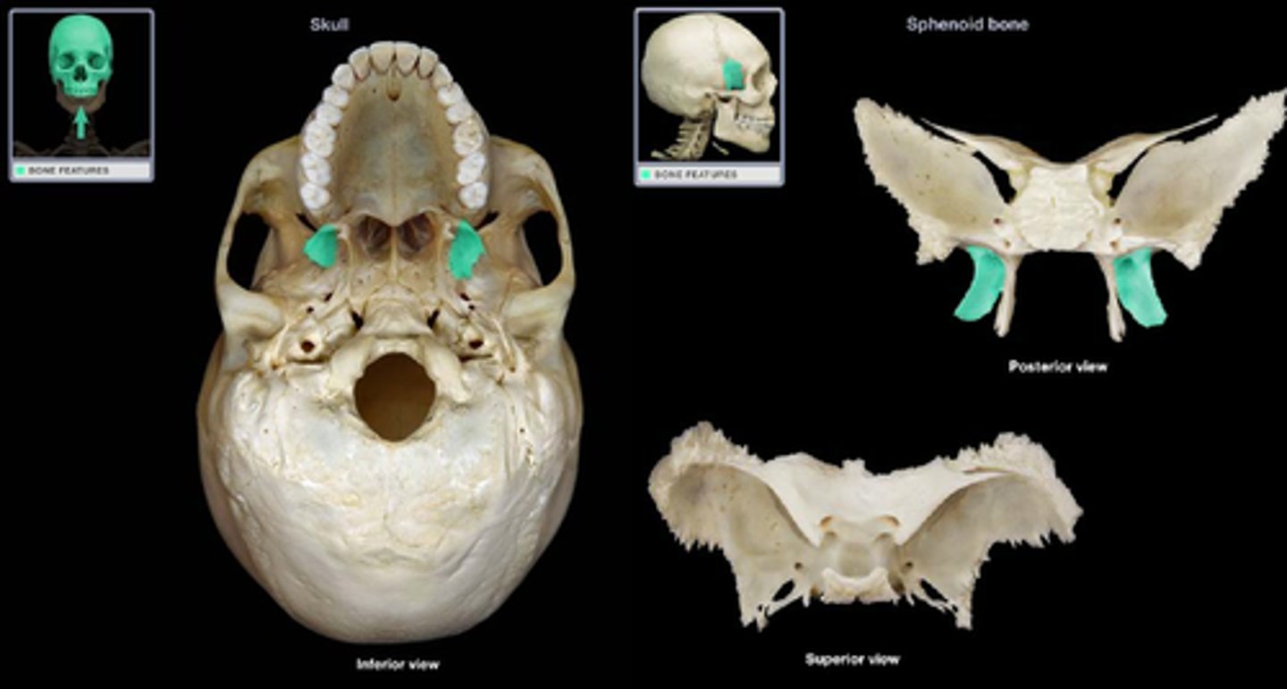 <p>what part of sphenoid is this?</p>