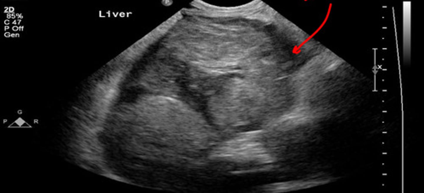 <p>is this a normal or abnormal liver US?</p>