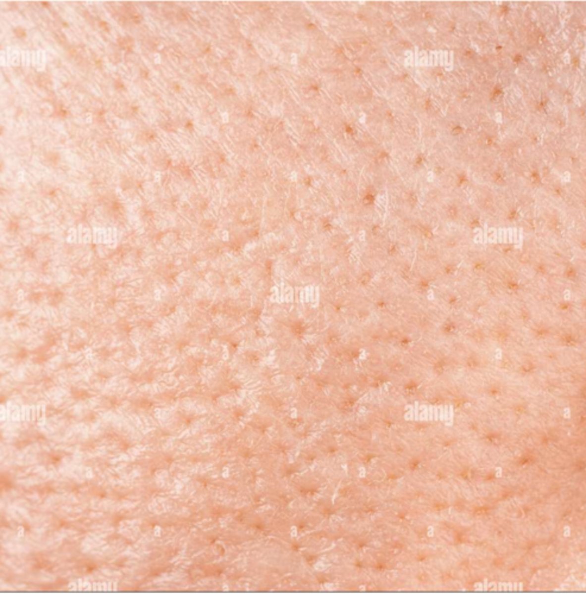 <p>¿lesión?</p><p>¿primaria o secundaria?</p>