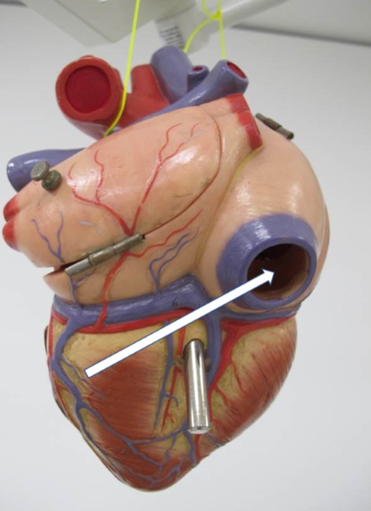 <p>bloedvat (dorso-caudaal zicht hart)</p>