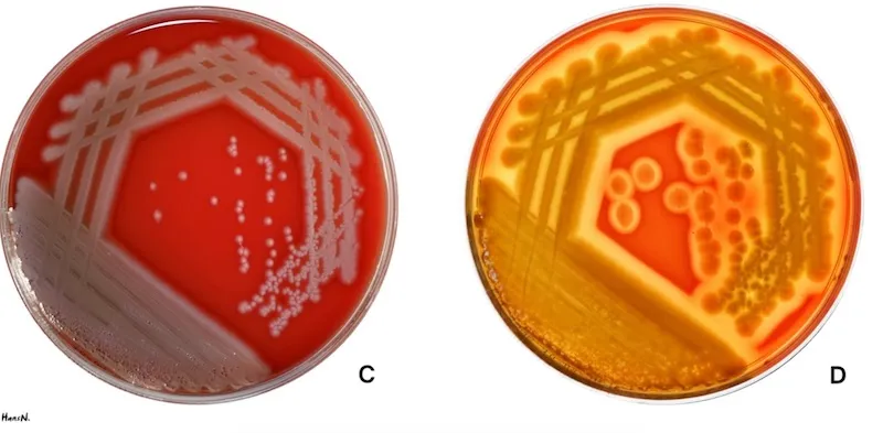 <p>What results do plate C indicate?</p>
