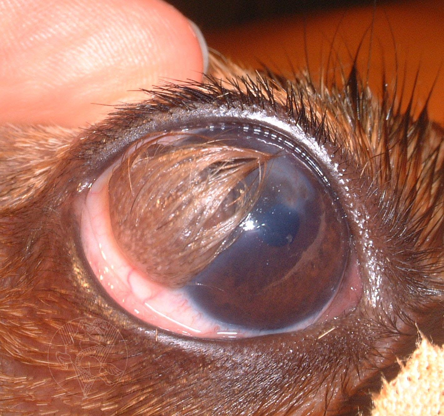 <p>Visible/palpable mass on the eyelid edge, usually near the lateral canthus, typically non-tender. May cause mild irritation or discomfort. Rarely, it may rupture causing acute inflammation and redness</p>