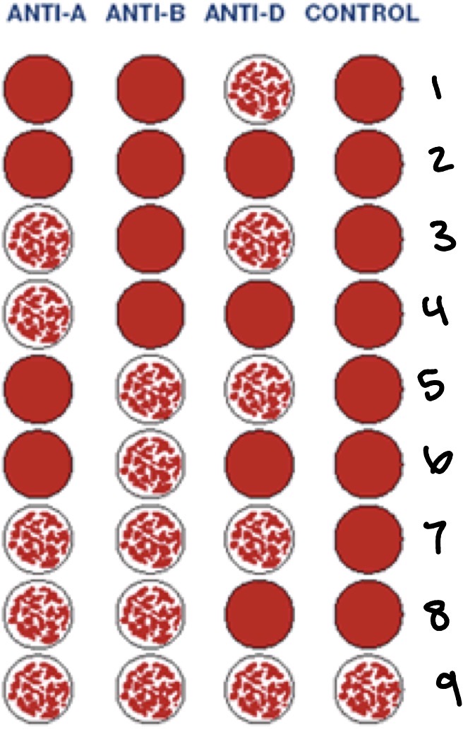 <p>Read the results of 2: What blood type is this, does it have the Rh factor</p>