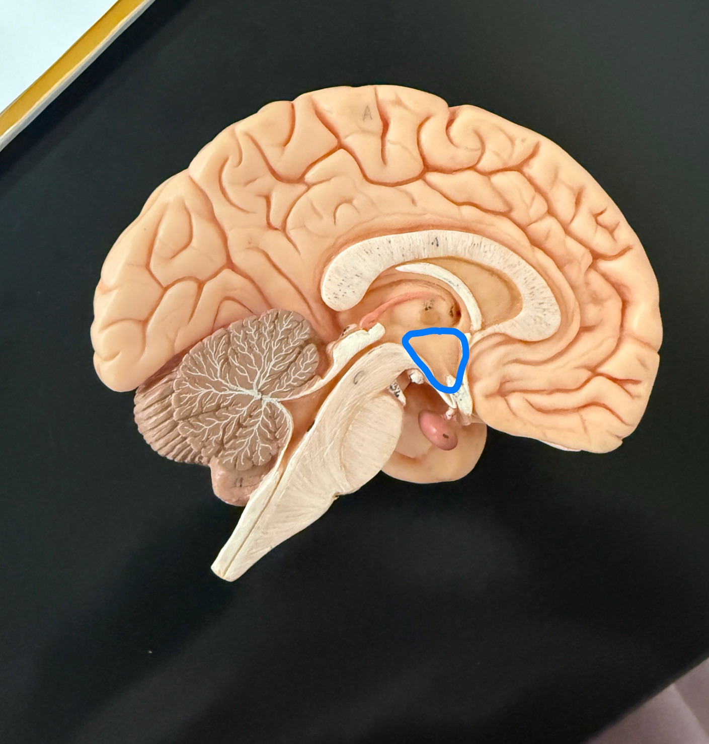 <p>What is outlined in blue on the brain model?</p>
