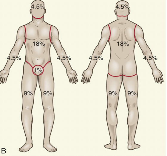 <p>o   TOTAL head (front and back): 9%</p><p>o   TOTAL arm (each, front and back): 9%</p><p>o   Total leg (each, front and back): 18%</p><p>o   Total trunk (front and back): 36%</p>