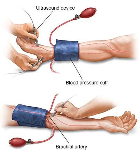 <p>What exam is being performed here? </p>
