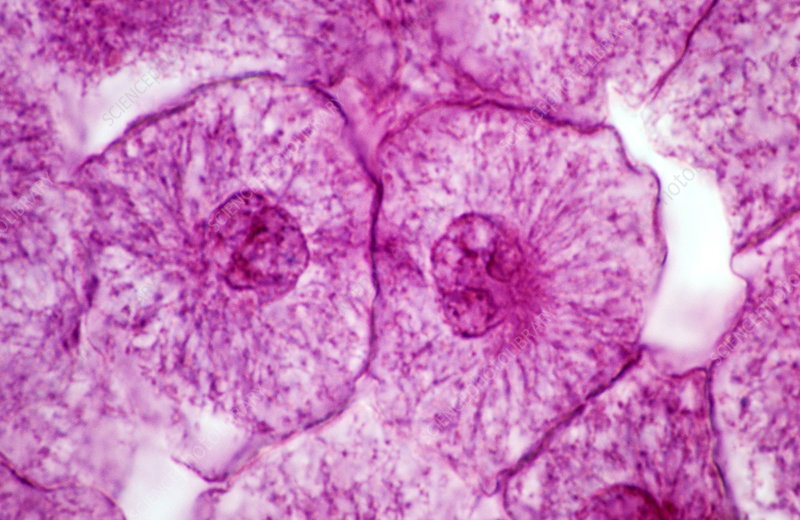 <p>what stage of the cell cycle is being showed here ?</p>