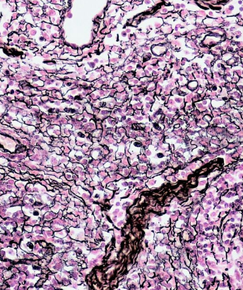 <ul><li><p><span style="font-family: Calibri">Fine fibers composed of collagen that form fine-meshed networks around cells and help maintain the integrity of organs</span></p></li><li><p><strong>Function</strong>: structural support of the liver, spleen, and lymph nodes</p></li><li><p>Mostly made up of reticular fibers (type III collagen)</p></li></ul><p></p>