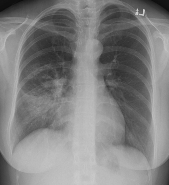 <p>Describe the abnormality demonstrated.</p>