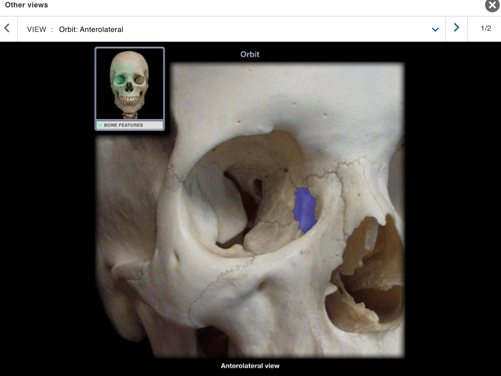 <p>Location:</p><ul><li><p>﻿﻿Orbit (anterior and medial)</p></li><li><p>﻿﻿Nasal cavity (lateral wall)</p></li></ul><p class="p1">Description:</p><ul><li><p>﻿﻿Smallest and most delicate bone of skull</p></li><li><p>﻿﻿Orbital surface contributes to fossa for lacrimal sac and<br>nasolacrimal groove</p></li><li><p>﻿﻿Nasal surface contributes to middle nasal concha</p></li></ul><p>Comment:</p><p class="p1">• Some fibers of orbicularis oculi attach to lacrimal bone</p>