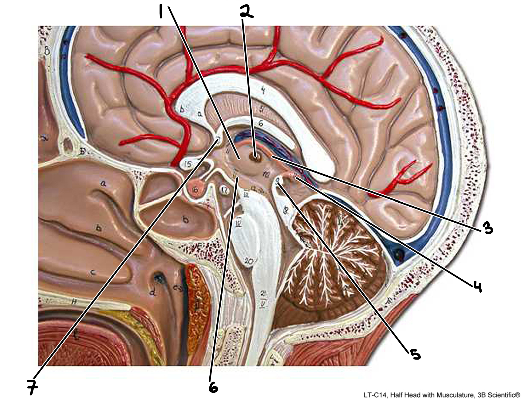 <p>Diencephalon: medial view </p>