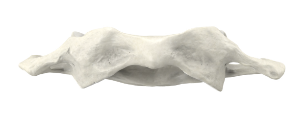 <p>Identify the part of the vertebra (side profile) and explain what diagnostic features helped you reach your conclusion.</p>