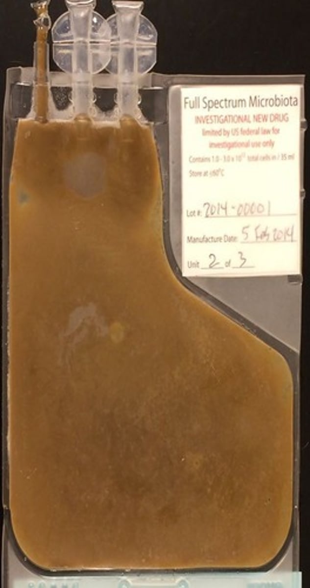 <p>A promising treatment for CDI involving the transfer of fecal matter from a healthy donor.</p>