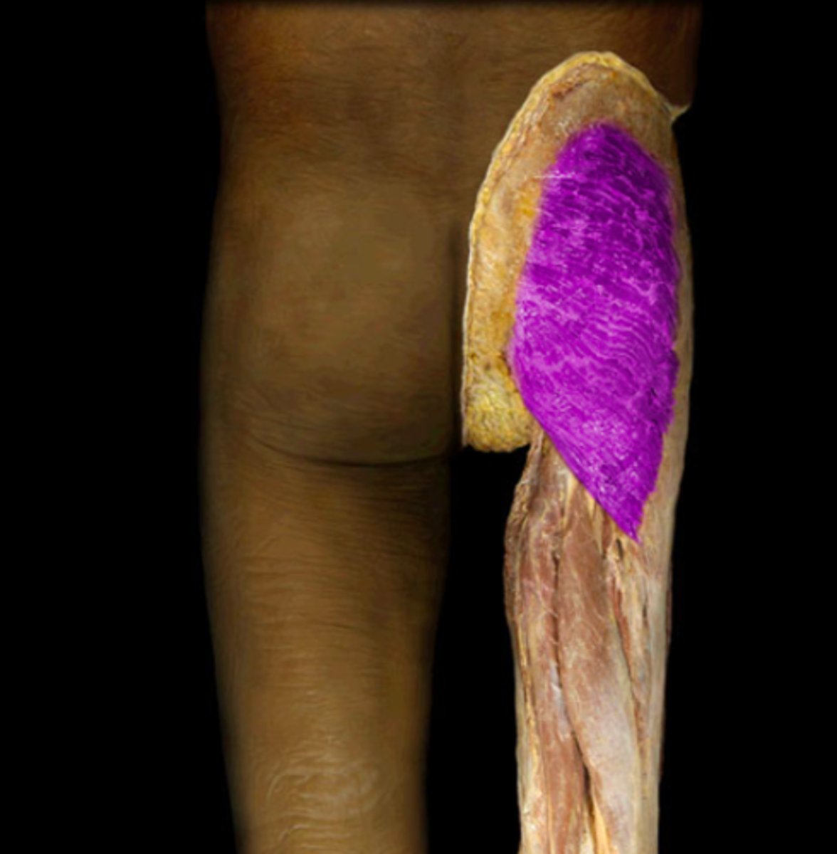 <p>Located on the lateral edge of the fascia lata, the iliotibial tract forms a wide sheath of fibrous connective tissue that surrounds the lateral thigh. It arises at its proximal end from the tendons of the tensor fasciae latae and gluteus maximus muscles.</p>
