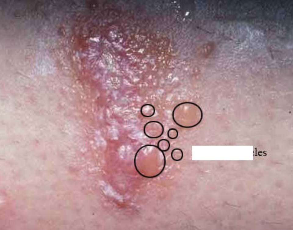 <p>what shape/arrangement and condition is depicted</p>